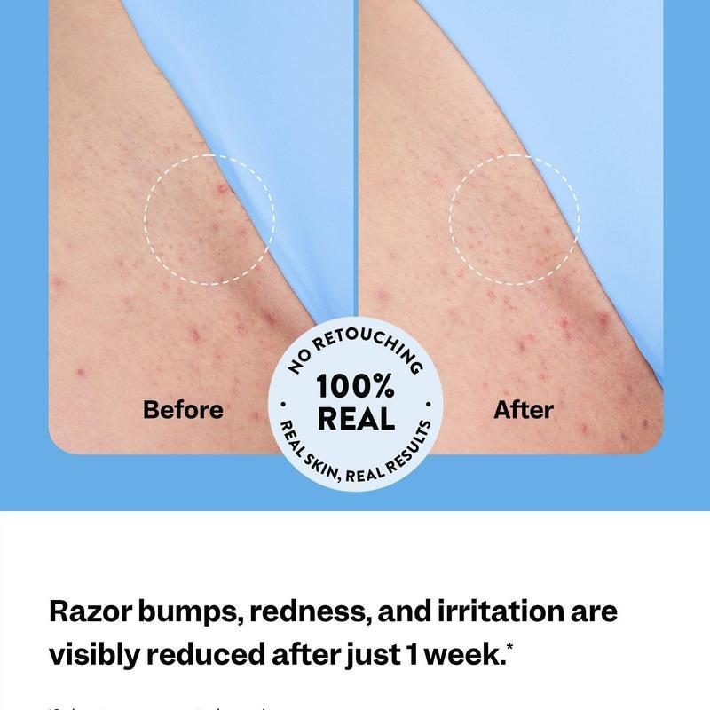 Peach Slices Smoothing Solution Ingrown Hair Treatment Glide Your Way To Silky-Smooth, Bump-Free Skin